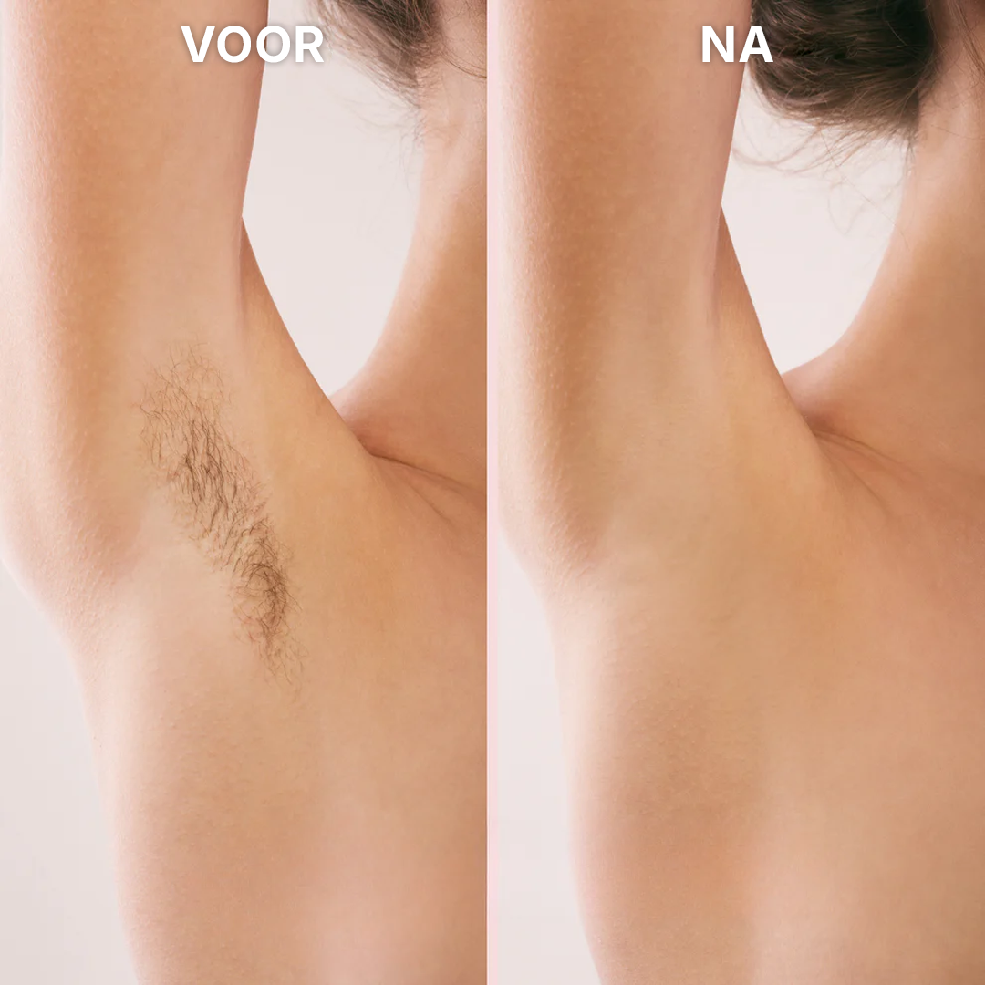 Bikinitrimmer Voor Vrouwen